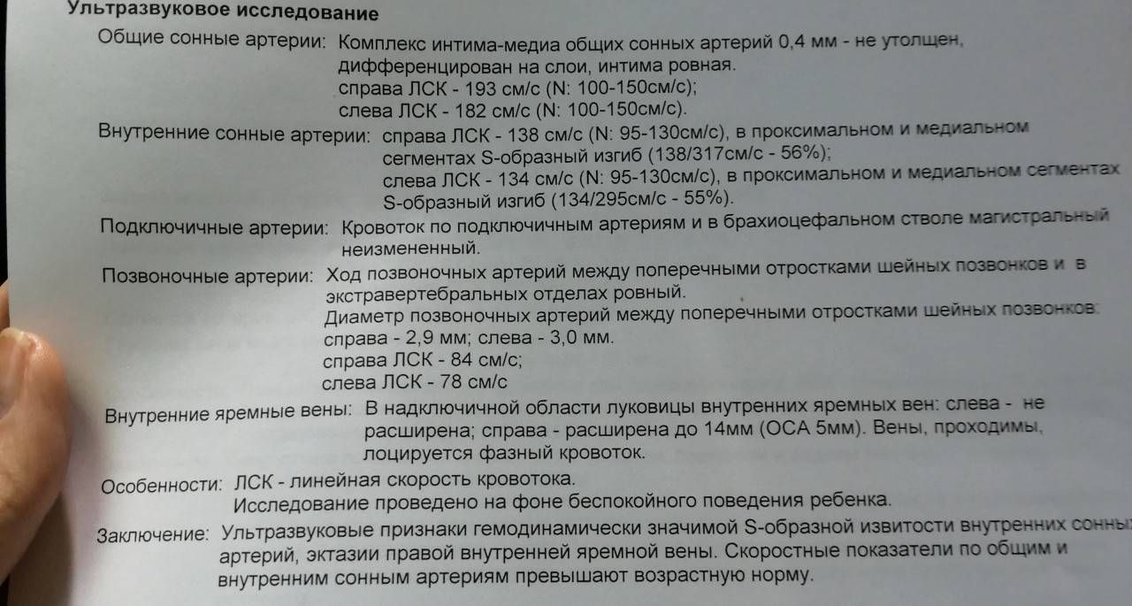Узи (уздг, уздс) - диагностика вен нижних конечностей