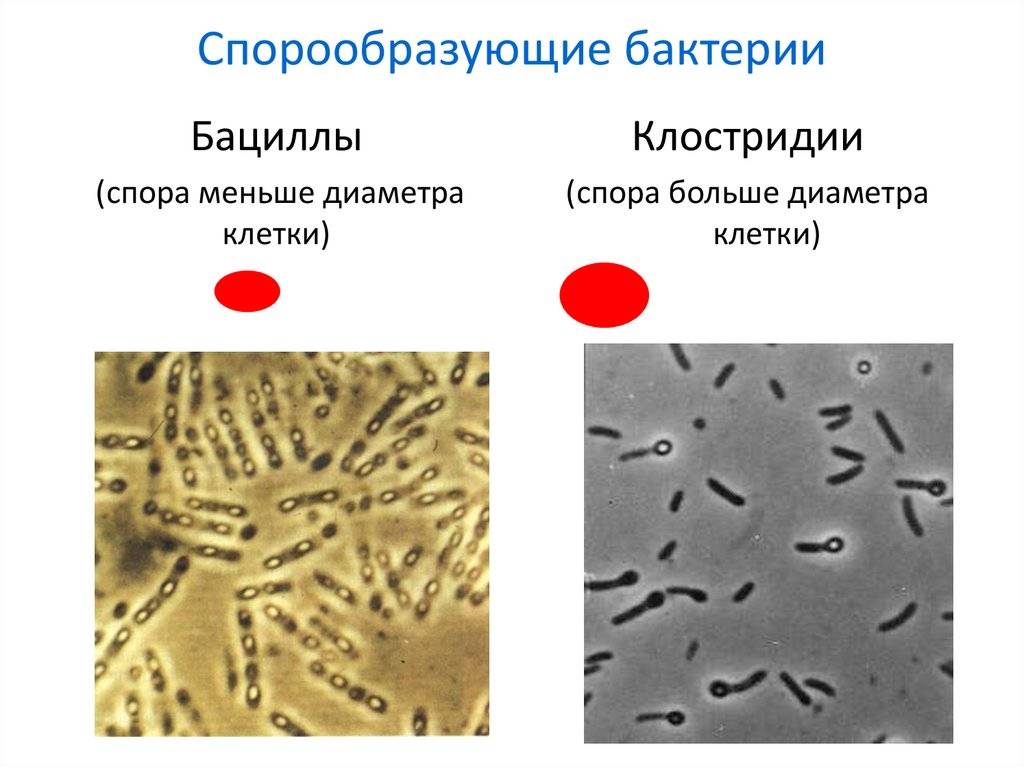 Спорообразующие бактерии: что это такое и как образуются (стадии)